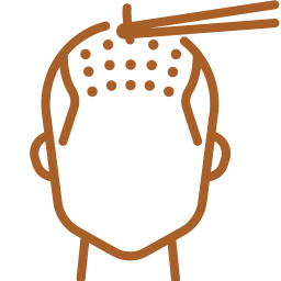 Hair Transplantation